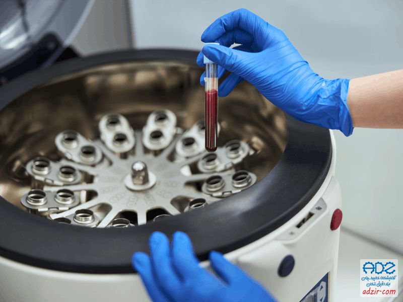 سانتریفوژ - (Centrifuge)-5